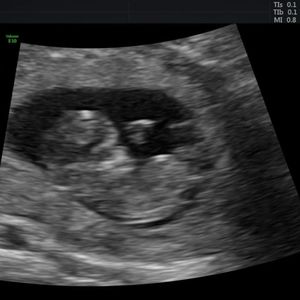 Meet your Posher, Traci